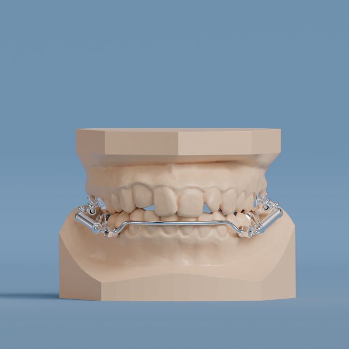 Higgins XBOW® Class II Corrector :: Great Lakes Dental Technologies