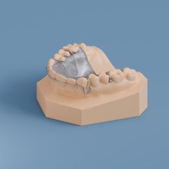 Upper Retainer with Hawley Labial Bow and Arrow Clasps
