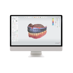 3Shape Splint Studio