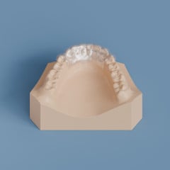 Composite Bonded (Braided Wire) Lingual Arch 3x3