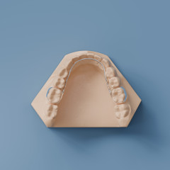 Lingual Arch with Loops (6x6)