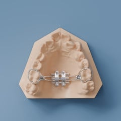 MSE - Maxillary Skeletal Expander