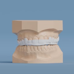 Nylon Flat Plane Splint