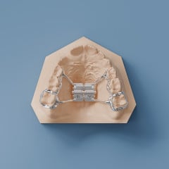 Rapid Palatal Expander - Sintered