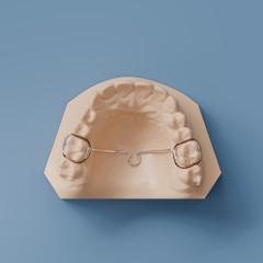 Fixed Transpalatal Arch