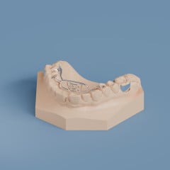 Custom Tongue Crib