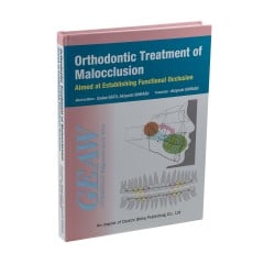Orthodontic Treatment of Malocclusion - Aimed at Establishing Functional Occlusion