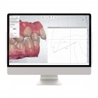 Orthodontic Planner