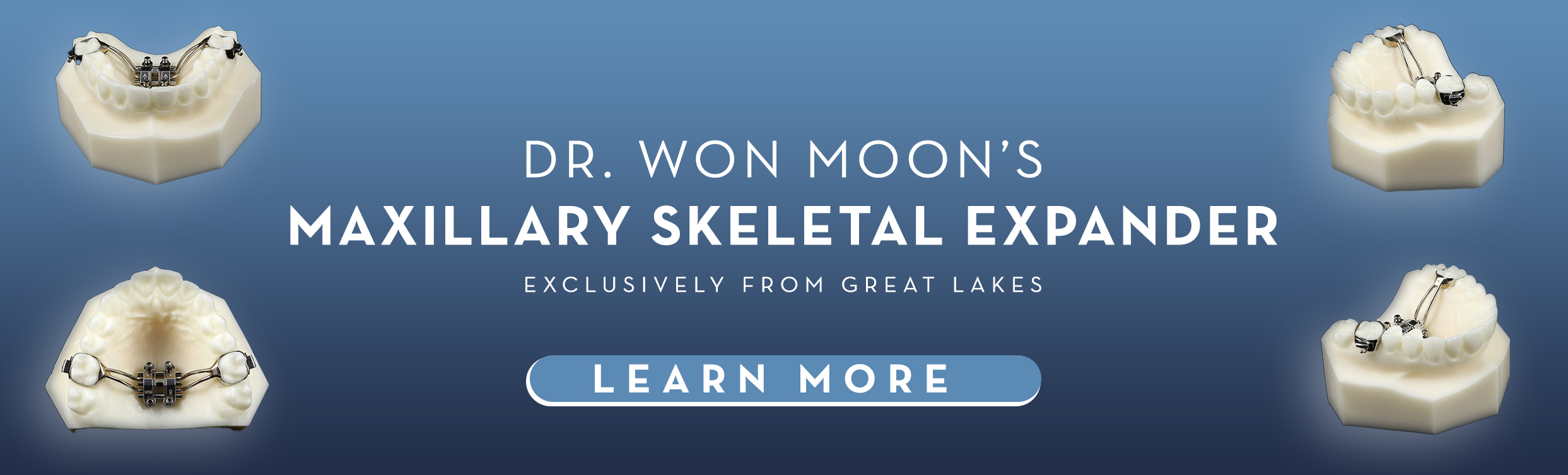 Dr. Won Moon's Maxillary Skeletal Expander (MSE)—Exclusively from Great Lakes