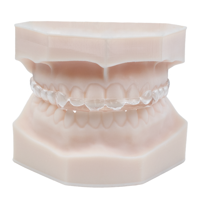 AccuGUARD deprogrammer appliance on upper and lower model in standard occlusion, straight on