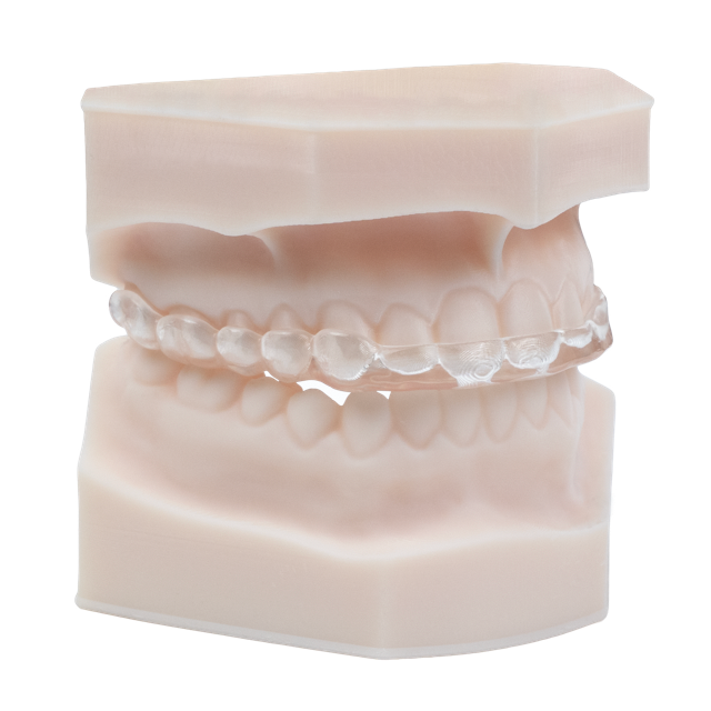 AccuGUARD deprogrammer appliance on upper and lower model in standard occlusion