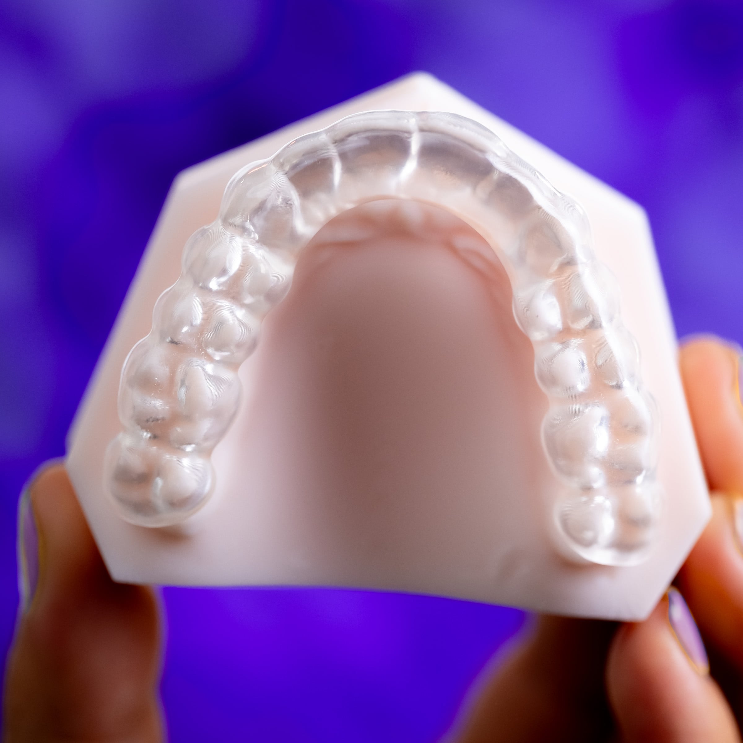 AccuGUARD Flat Plan appliance from Great Lakes Dental Technologies on upper model over abstract background