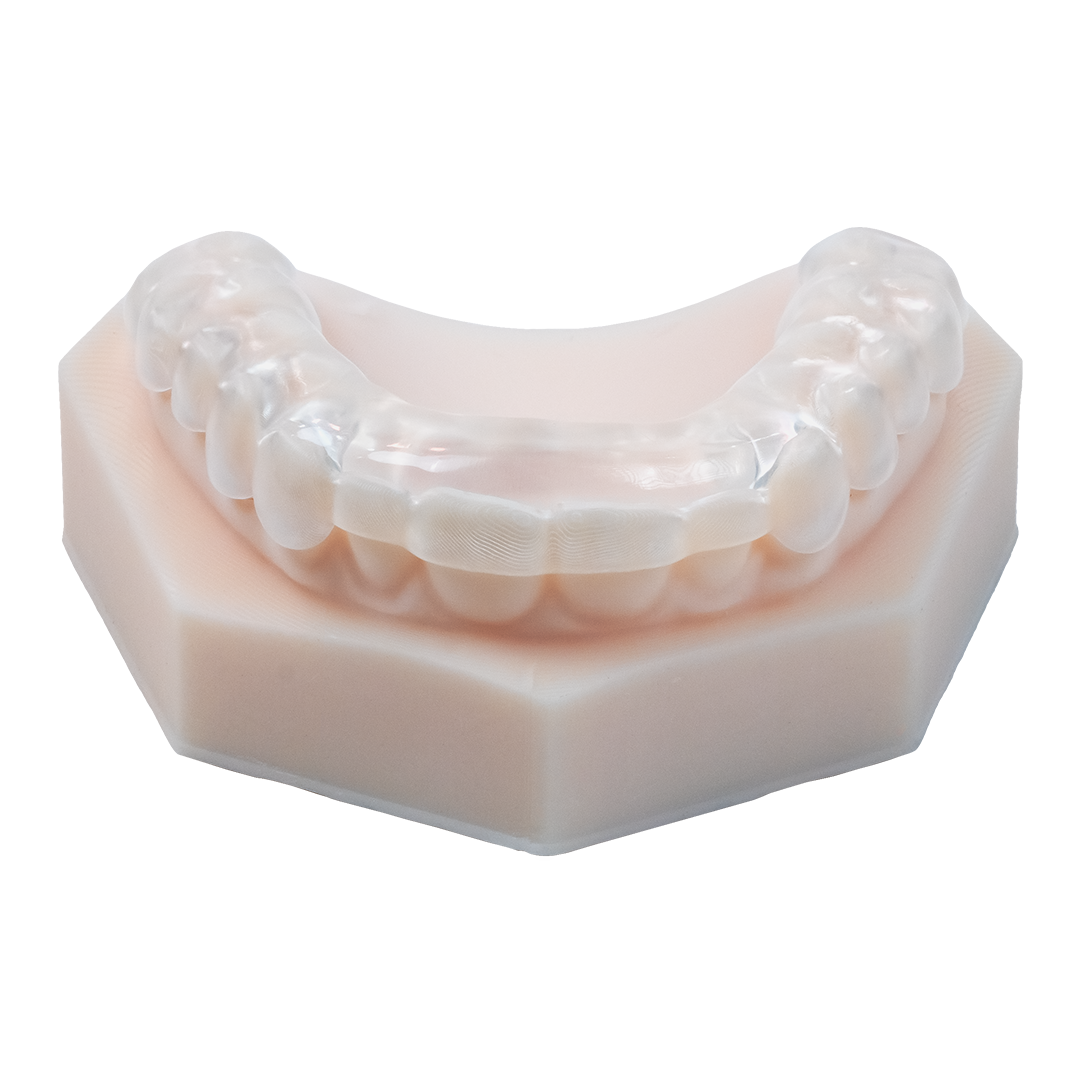 AccuGUARD appliance on upper model with occlusal side facing up, straight on