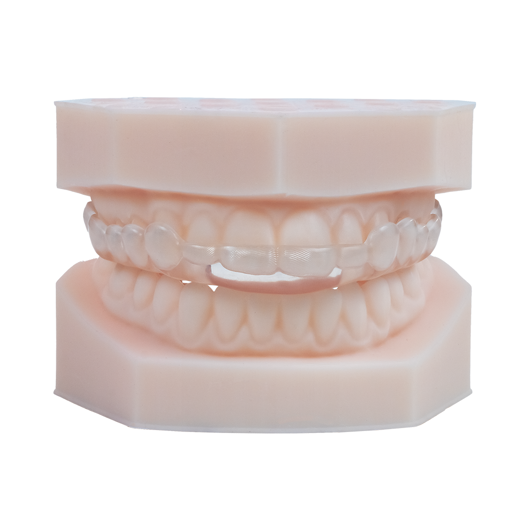 AccuGUARD appliance on upper and lower model in standard occlusion, straight on