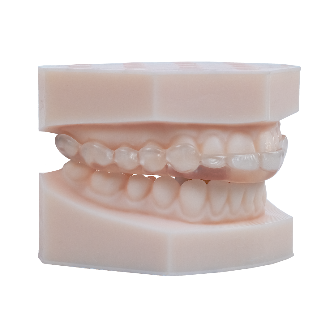AccuGUARD appliance on upper and lower model in standard occlusion